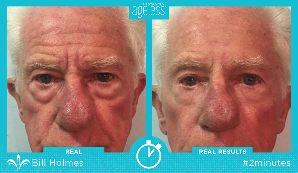 Instantly Ageless Exemple 1