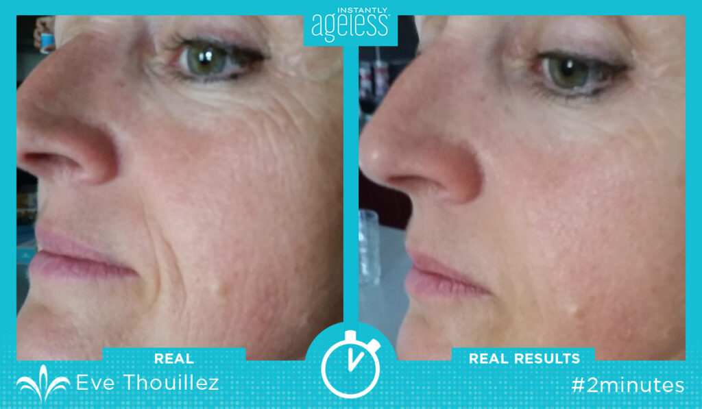 Instantly Ageless Exemple 2