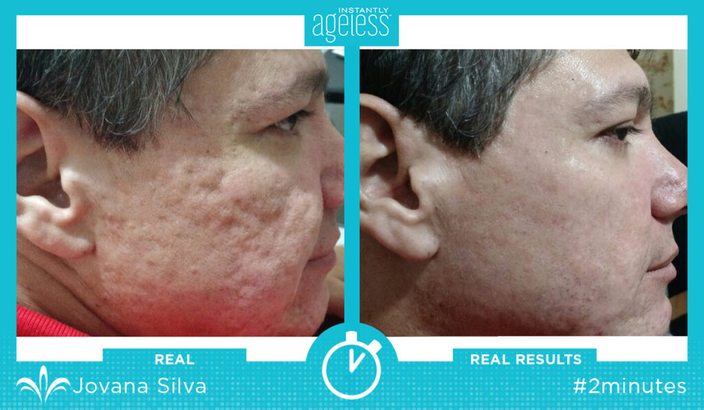 Instantly Ageless Exemple 4