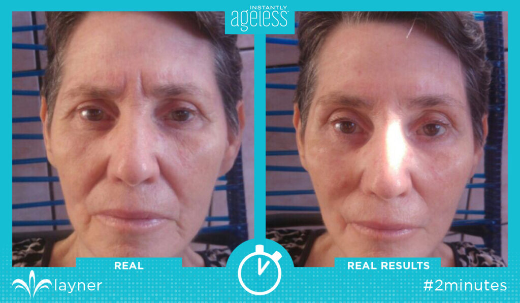 Instantly Ageless Exemple 5
